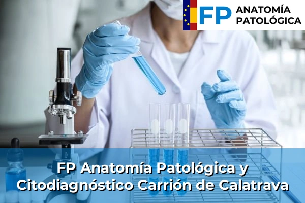 FP Anatomía Patológica y Citodiagnóstico en Carrión de Calatrava