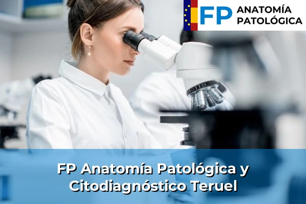 FP Anatomía Patológica y Citodiagnóstico en Teruel