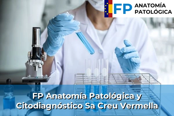 FP Anatomía Patológica y Citodiagnóstico en Sa Creu Vermella